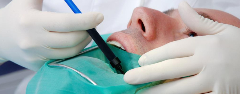 Root Canal Treatment Centre in Salmiya